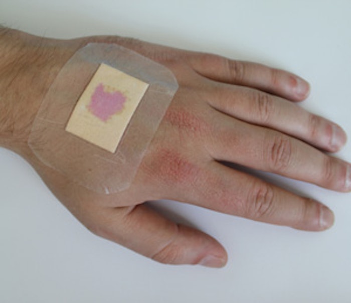 The wound dressing is formulated with an indicator dye that turns purple when the skin underneath is infected. *Photo courtesy of Fraunhofer EMFT