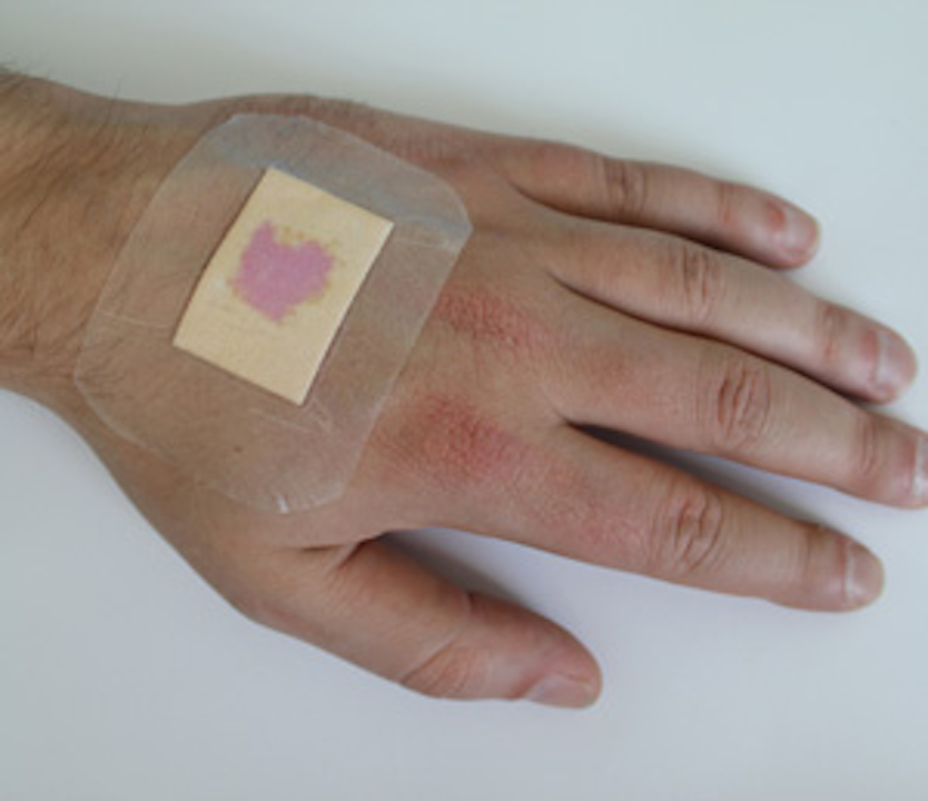 Scientists Develop Dye for Wound Dressings to Indicate Infection