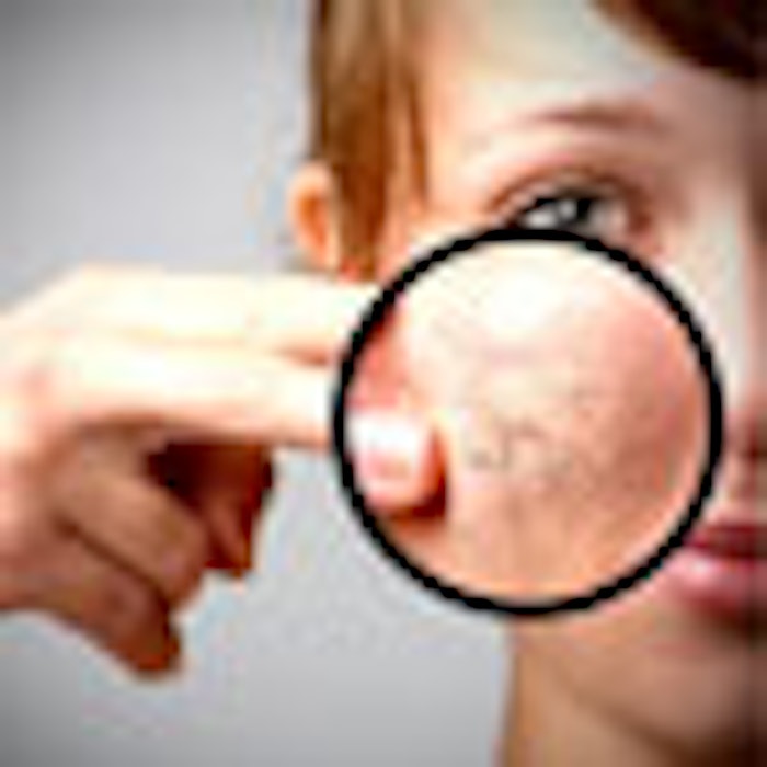 skin_close_up_f2