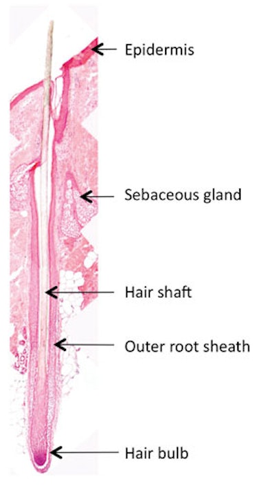Targeting the Hair Follicle Basement Membrane to Improve Growth Conditions  In vitro | Cosmetics & Toiletries