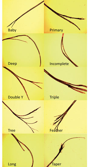 Hair Loss to Dandruff to Split Ends: Common hair problems and their  remedies | PINKVILLA