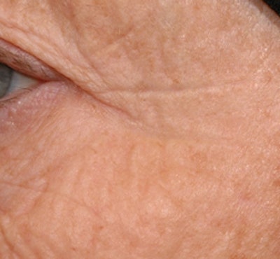 CTNL060315_Juvinity-after