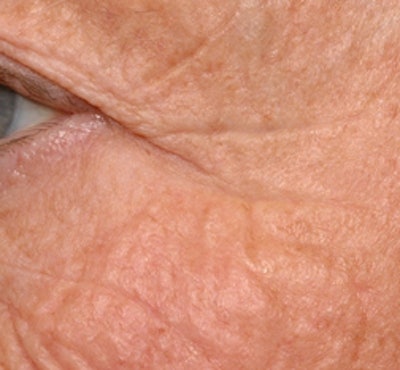 CTNL060315_Juvinity-before