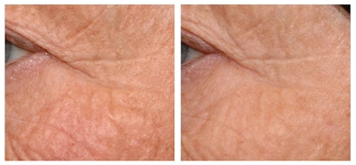 CTNL060315_Juvinity-before_after