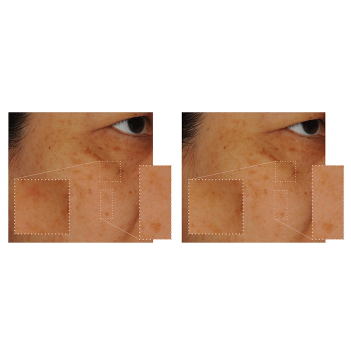 MediatoneSederma_CT1511_800