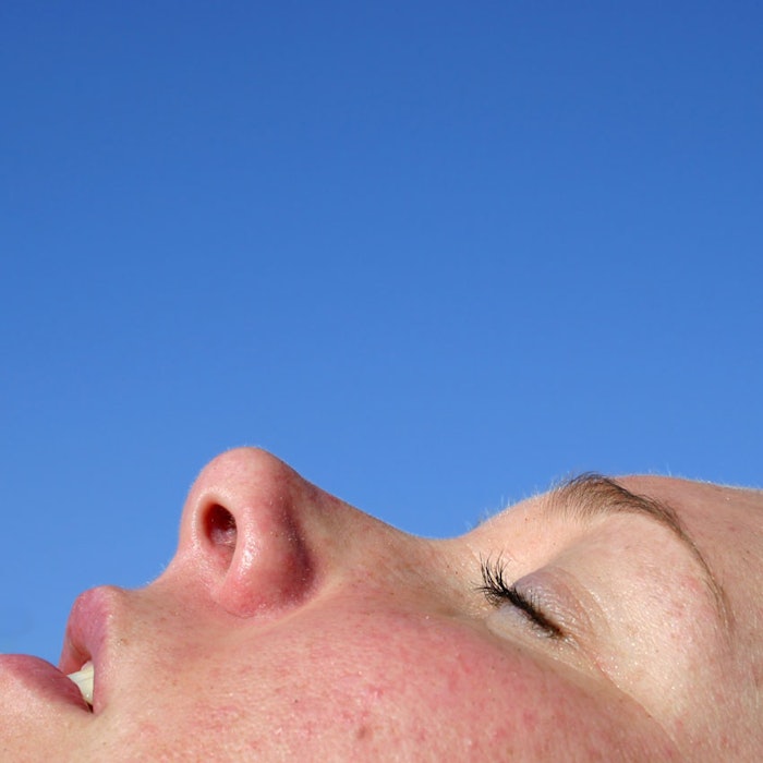 FaceProfileSunburn850