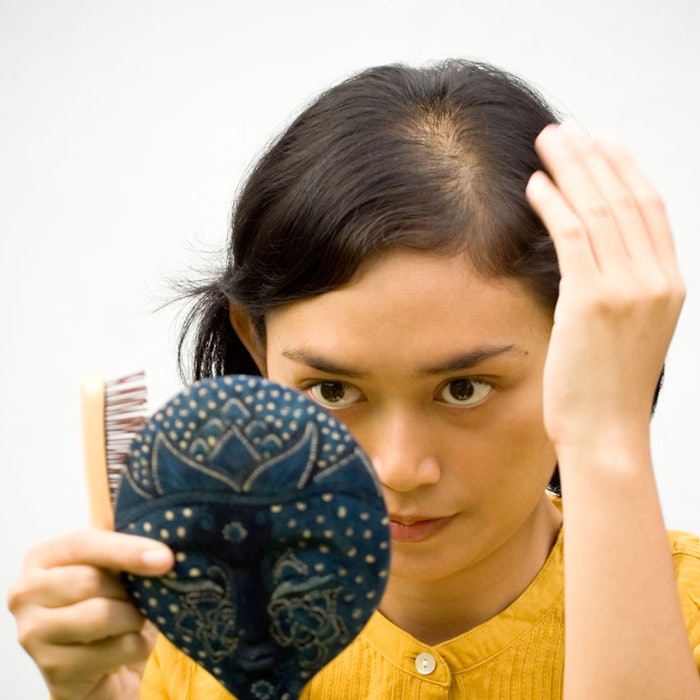 BrunetteHairLoss850