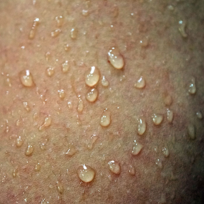 WaterDropsOnSkin850