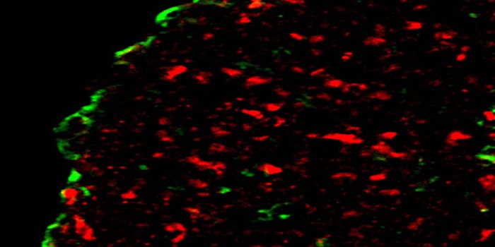 850x425_BRAIN