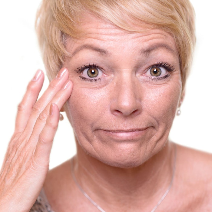 WomanLookingatAgedSkin850