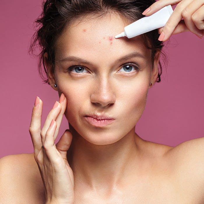 WomanTreatingAcne850