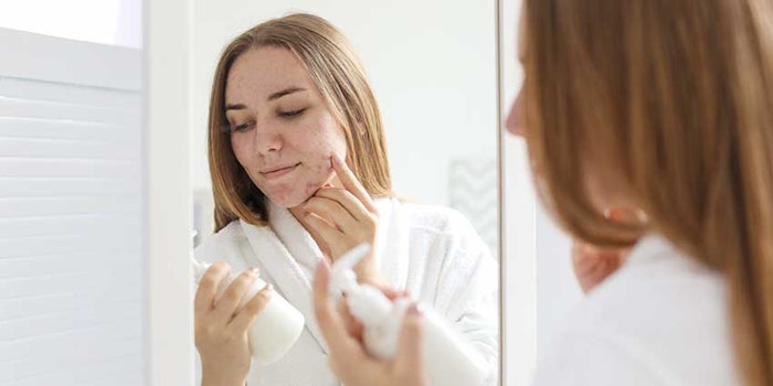 acneproductwoman_425