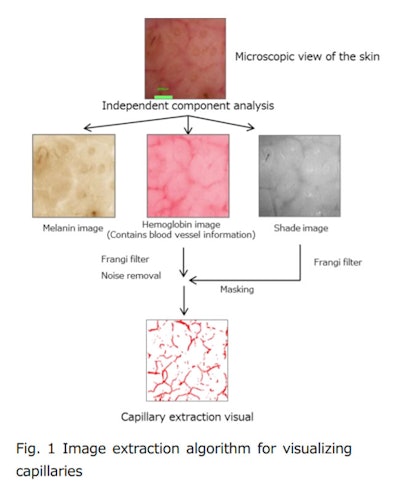 Using this technique, researchers analyzed differences in skin with age, which revealed that women in their twenties and thirties with higher blood flow tended to have better skin texture patterns. In contrast, women in their fifties and sixties also having higher blood flow had smaller cell sizes in the stratum corneum. According to the researchers, this suggests the epidermal cells were activated.