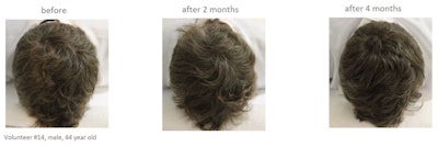 Ashland Ct1910 Image