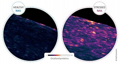 OxiProteomicsNailScan