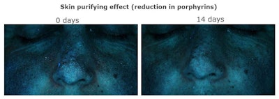 ReductioninPorphyrins750
