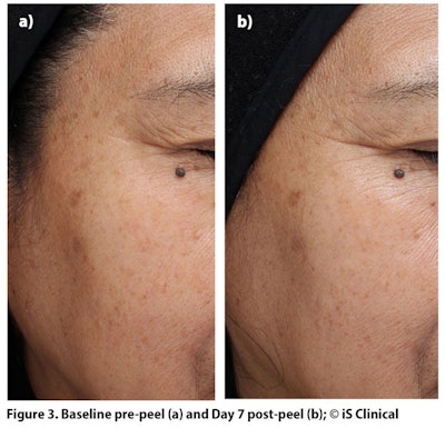 DeHaven_Peels_Figure3