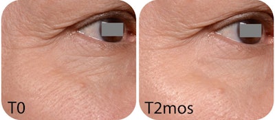 SedermaBefore-After750