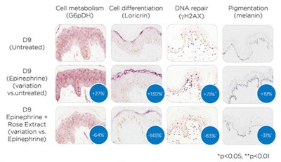 For more information, contact IFF/Lucas Meyer.