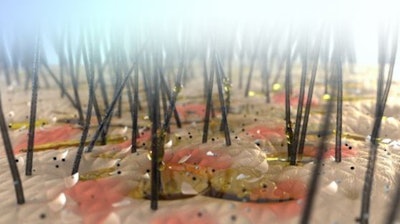 The microbiome is a collection of teeny, tiny lifeforms — or a complex community of interdependent microbes, if you want to get technical. The external factors we talked about asphyxiate the scalp (yikes!) and throw it off balance, creating an environment where problematic strains of microbes start to outnumber the beneficial ones. That’s where a detox comes in.