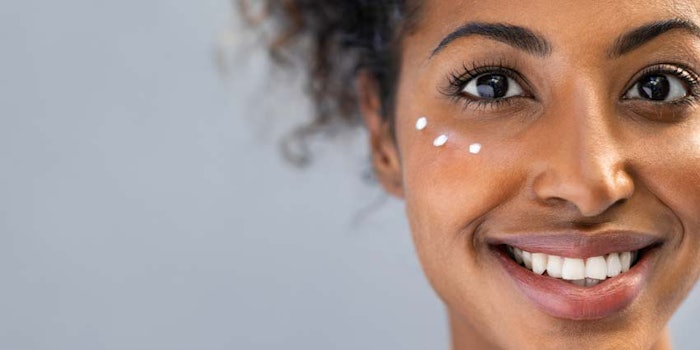 WomanwithLotionSpotsonFace850x425