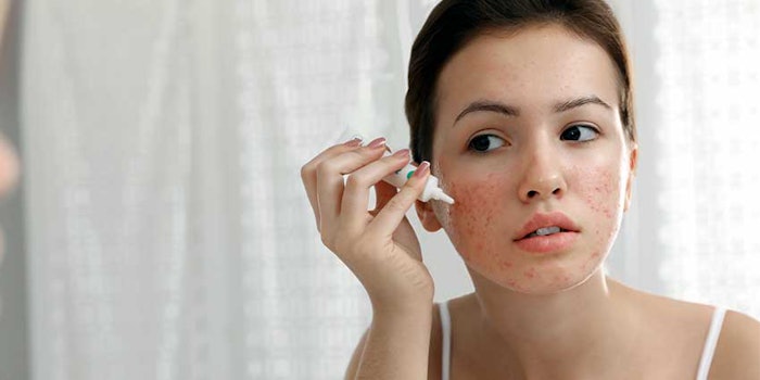Benzoyl Peroxide A Review