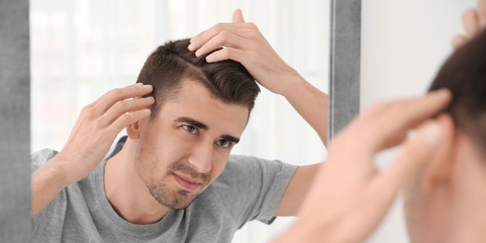 ManInspectingHairLossScalp_850x425