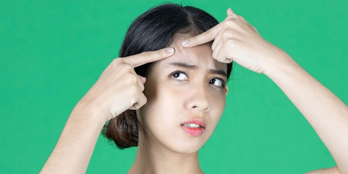 WomanPushingAcneBlemishWorried_850x425