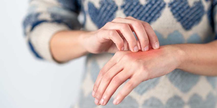 Researchers from Newcastle University, the Wellcome Sanger Institute and Kings College London have discovered developmental origins of eczema and psoriasis, leading to possible treatment and new research possibilities for other inflammatory diseases.