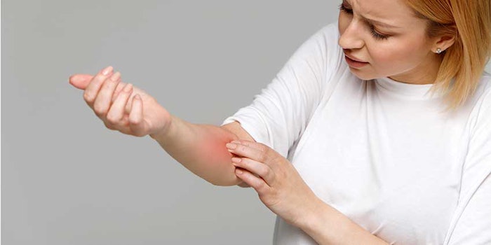 Sytheon evaluated the topical effects of patented isosorbide di-(linoleate/oleate) (IDL) as a xerotic pruritic skin treatment.