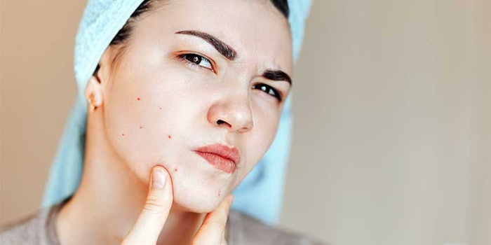 Silab Softcare has developed a 3D in vitro model of acneic skin as a screening tool for acne treatments.