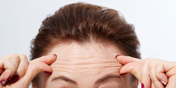 Treating Wrinkles With Dimethylaminoethanol Retinol And Mineral Salts