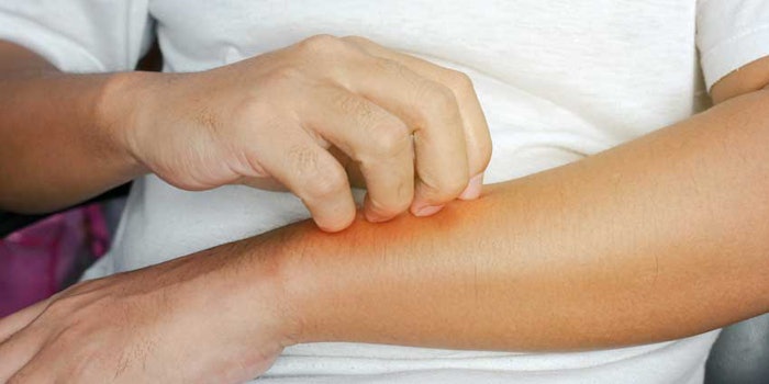 Two seaweed extracts have been found effective as topical agents to treat atopic dermatitis.