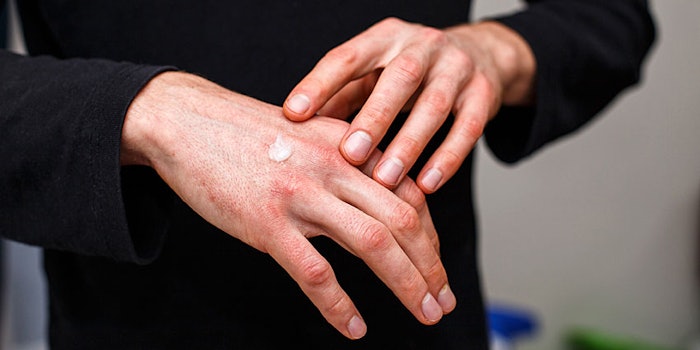 Sytheon and Symbionyx have expanded research of isosorbide esters and were able to find ways of making IDMF a candidate to treat skin conditions such as psoriasis.