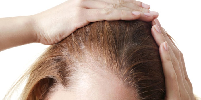 Pumpkin seed oil's ability to help decrease vellus hair and hair shaft diversity gives it great potential for use in female pattern hair loss treatment.