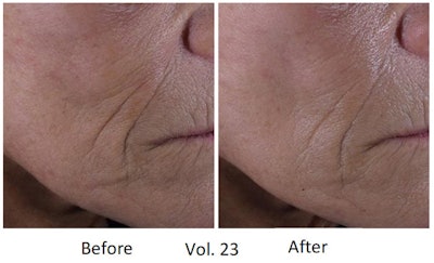 Gattefosse Ct2110 Image2 Re Size