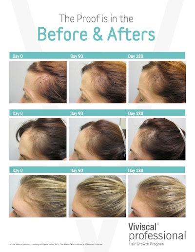 Viviscal Blp2110 Image4