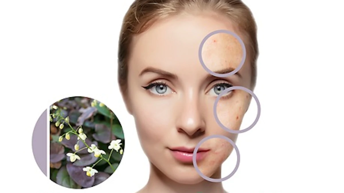 Biocogent Inhibits C. acnes with Grandiciin - Vimarsana News