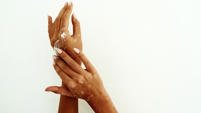 Of natural origin, Castaline was clinically proven to support the skin barrier and comfort atopic-prone skin.