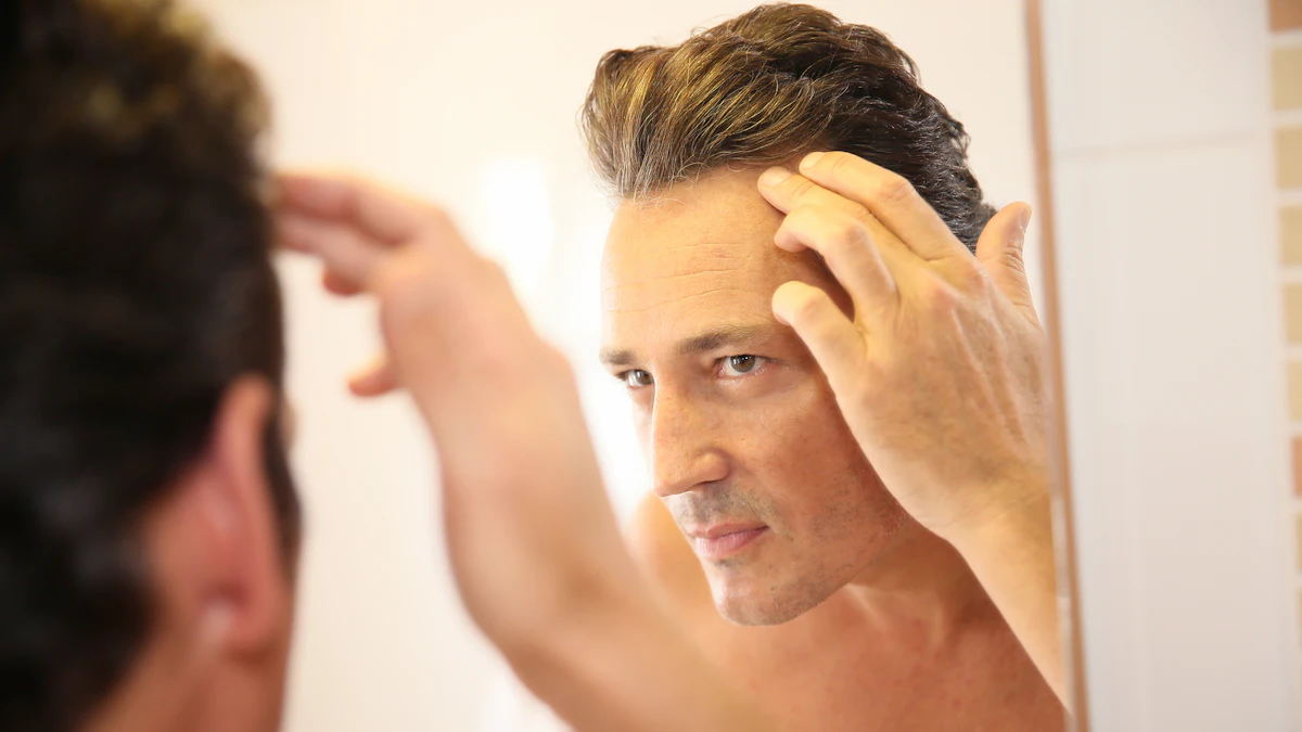 Follica Announces Presentation of Unmet Treatment Needs of Androgenetic Alopecia - Vimarsana News