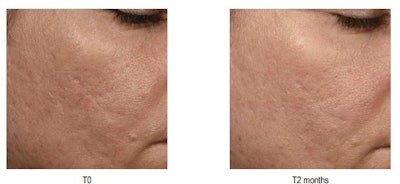 Bb Biont Clinical Trials