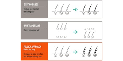 Follica Modality Comparison