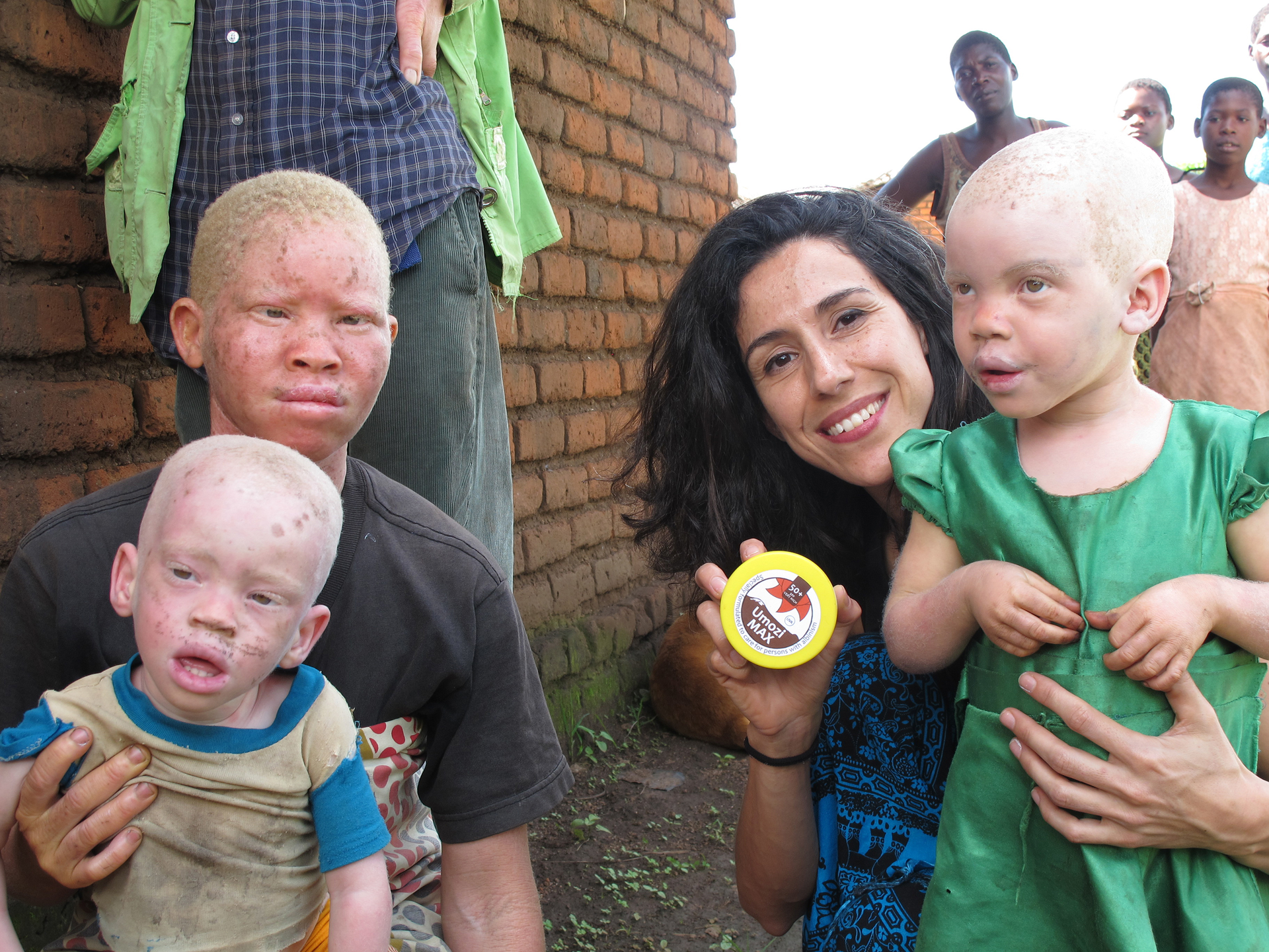 BASF and Beyond Suncare Renew Partnership on African Albinism Project