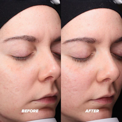 Eighty percent of respondents in the regimen user trial said their pores appeared reduced in size after committing to and using the routine.