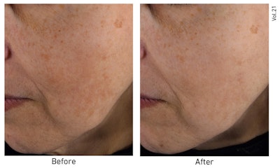 Gattefosse Ct Bc 04 18 22 Image2