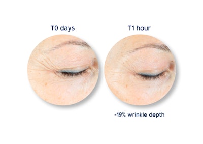 Lipo True Ct We 05 02 22 Jp Image2