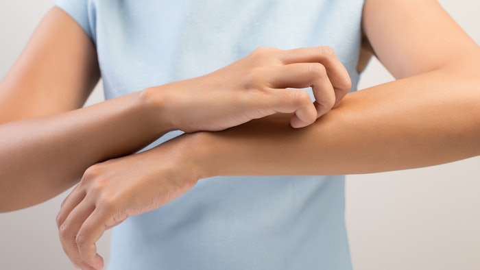 Woman itching skin on her arm.