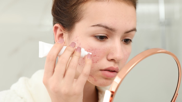 In this installment of 'Formulating on Trend,' the author talks about anti-acne products with a particular usage of certain ingredients to make products OTC. Described here are the types of acne, emollients and occlusives to optimize anti-acne efficacy.