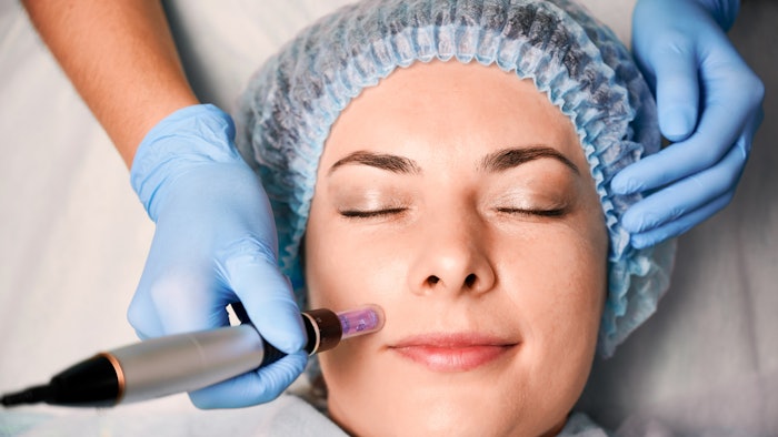 Woman Receiving Microneedling Treatment