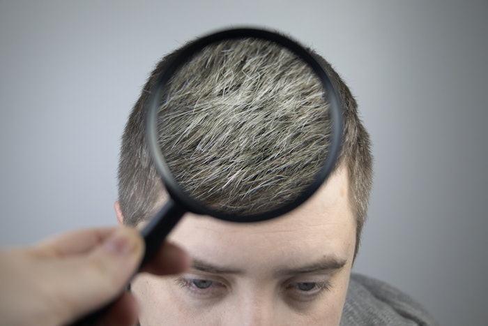 The main focus of this research published in the Journal of Cosmetic Dermatology was to define the differences in the hair follicle lipid profiles of female black and gray/white hair follicles.